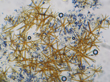 APII jpeg image of Asterostroma cervicolor  © contact APII